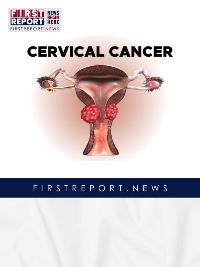 Cervical Cancer and HPV: What Every Woman Needs to Know
