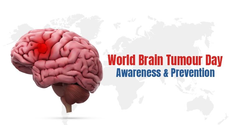 World Brain Tumour Day awareness graphic highlighting advances in brain tumor treatment and survival
